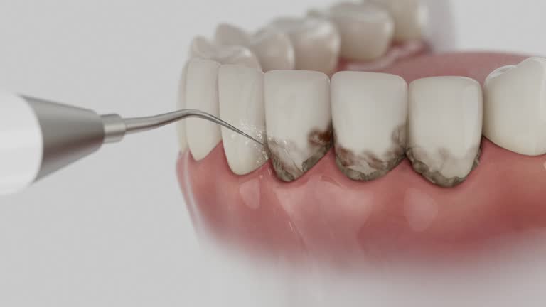 Reliable Emergency Dentist contractor in Belvedere, CA by Smile Center Dentistry